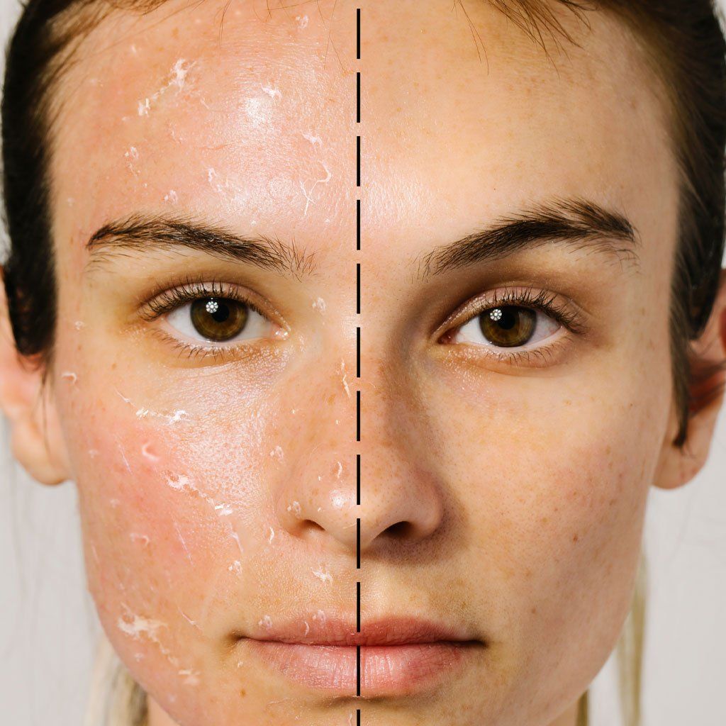 Bioactive Rose Gommage - Odacite Sweden